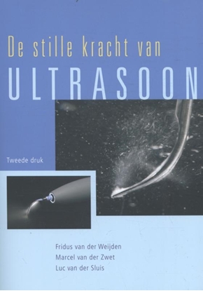 Afbeeldingen van De stille kracht van Ultrasoon