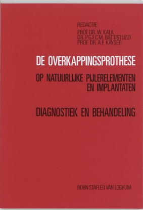 Afbeeldingen van De overkappingsprothese op natuurlijke pijlerelementen en implantaten