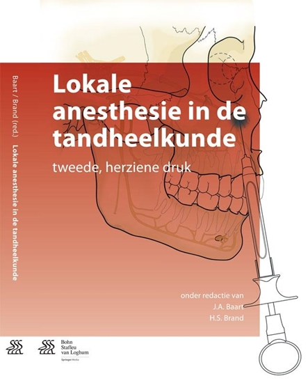 Afbeelding van Lokale anesthesie in de tandheelkunde