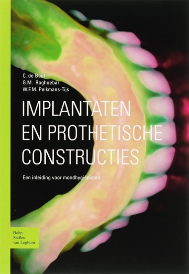 Afbeelding van Implantaten en prothetische constructies