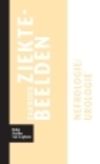Afbeelding van Zakboek Ziektebeelden Zakboek ziektebeelden Nefrologie / Urologie