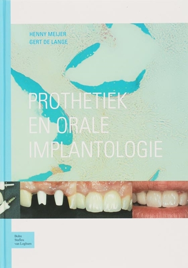 Afbeelding van Prothetiek en orale implantologie