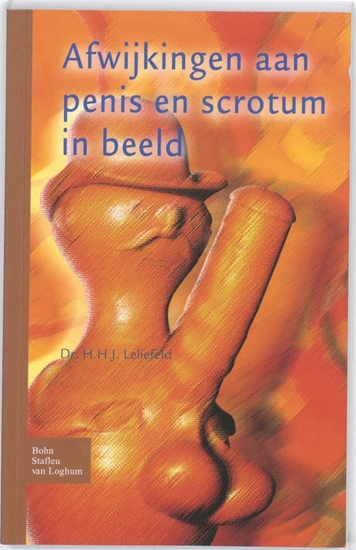 Afbeelding van Afwijkingen aan penis en scrotum in beeld
