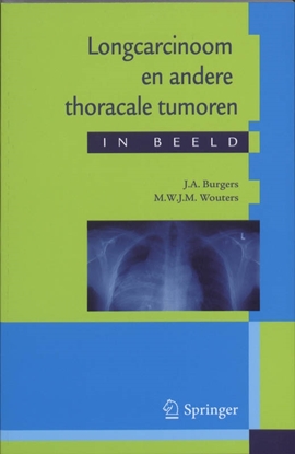 Afbeeldingen van Longcarcinoom en andere thoracale tumoren in beeld