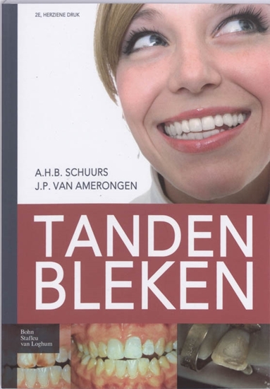 Afbeelding van Tanden bleken