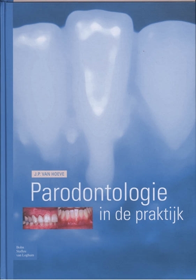 Afbeelding van Parodontologie in de Praktijk
