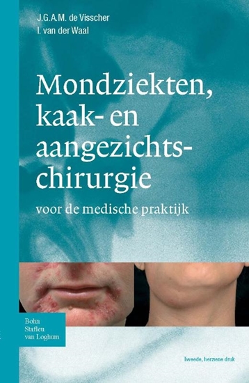 Afbeelding van Zakboek Ziektebeelden Zakboek mondziekten, kaak- en aangezichtchirurgie