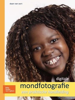 Afbeeldingen van Digitale mondfotografie