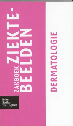 Afbeeldingen van Zakboek Ziektebeelden Zakboek ziektebeelden Dermatologie