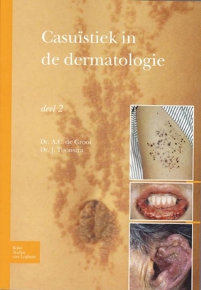 Afbeeldingen van Casuïstiek in de dermatologie