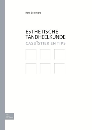 Afbeeldingen van Esthetische Tandheelkunde