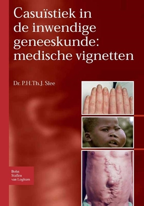 Afbeeldingen van Casuïstiek in de inwendige geneeskunde: medische vignetten