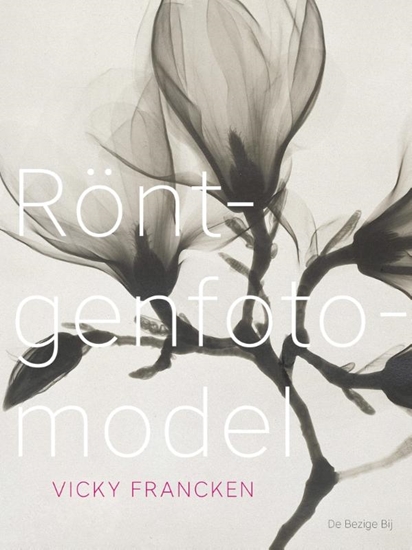 Afbeelding van Röntgenfotomodel