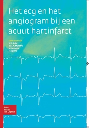Afbeeldingen van Het ECG en het angiogram bij een acuut hartinfarct