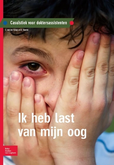 Afbeelding van Ik heb last van mijn oog