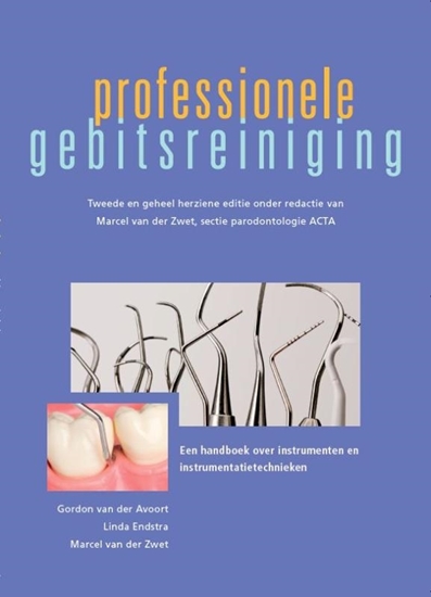 Afbeelding van Professionele gebitsreiniging