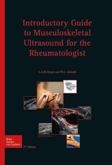 Afbeelding van Introductory guide to musculoskeletal ultrasound for the rheumatologist