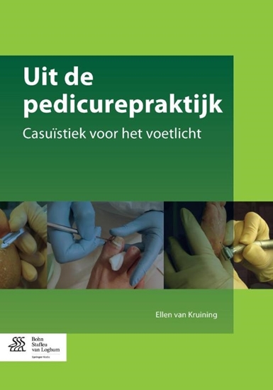 Afbeelding van Uit de pedicurepraktijk