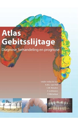 Afbeeldingen van Atlas gebitsslijtage