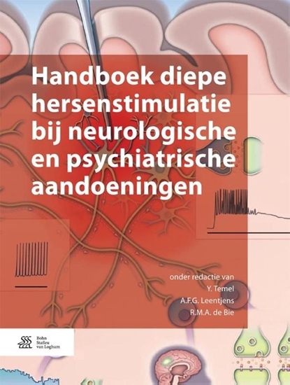 Afbeelding van Handboek diepe hersenstimulatie bij neurologische en psychiatrische aandoeningen