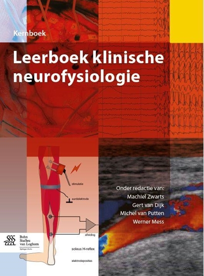 Afbeelding van Leerboek klinische neurofysiologie