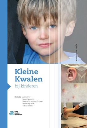 Afbeeldingen van Kleine Kwalen bij kinderen
