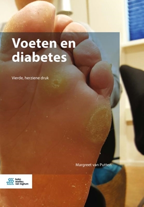 Afbeeldingen van Voeten en diabetes