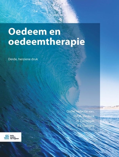 Afbeelding van Oedeem en oedeemtherapie