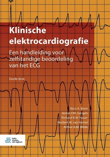 Afbeelding van Klinische elektrocardiografie