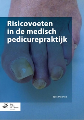 Afbeeldingen van Risicovoeten in de medisch pedicurepraktijk