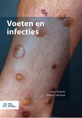 Afbeeldingen van Voeten en infecties