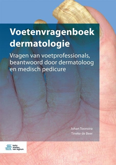 Afbeelding van Voetenvragenboek dermatologie