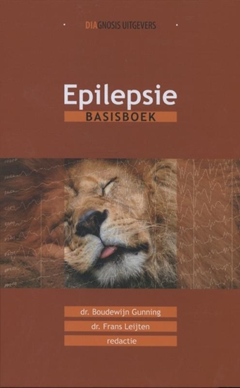 Afbeelding van Epilepsie