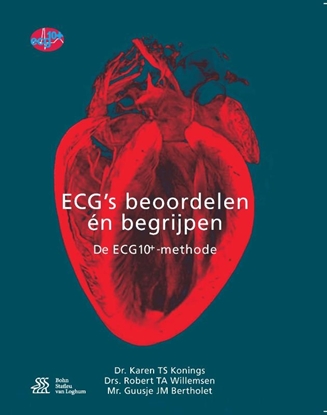Afbeeldingen van ECG's - beoordelen én begrijpen