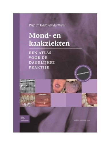 Afbeelding van Mond- en kaakziekten