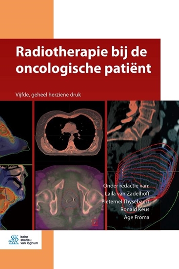 Afbeelding van Medische beeldvorming en radiotherapie Radiotherapie bij de oncologische patiënt