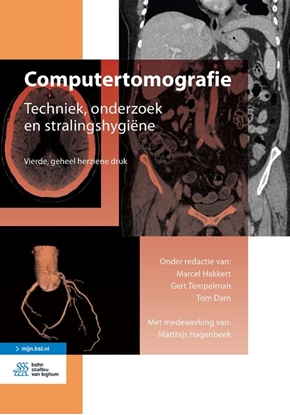 Afbeeldingen van Medische beeldvorming en radiotherapie Computertomografie