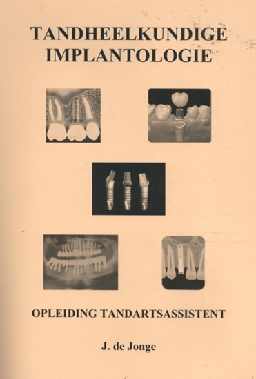 Afbeelding van Tandheelkundige Implantologie