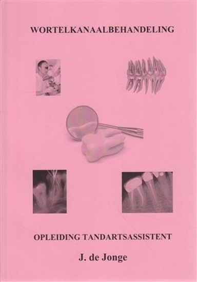 Afbeelding van Wortelkanaalbehandeling