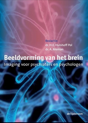 Afbeeldingen van Beeldvorming van het brein