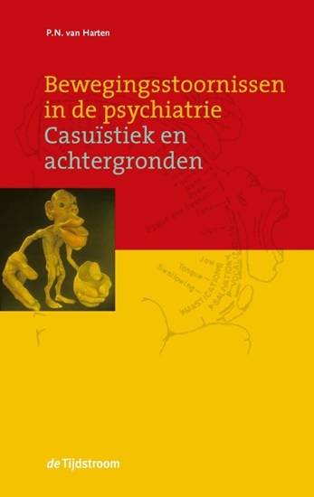 Afbeelding van Bewegingsstoornissen in de psychiatrie