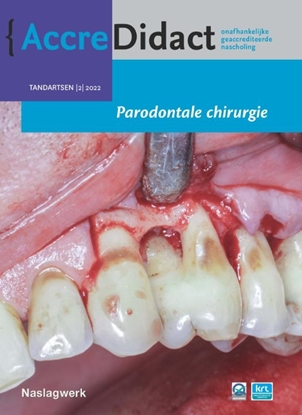 Afbeeldingen van AccreDidact Parodontale chirurgie