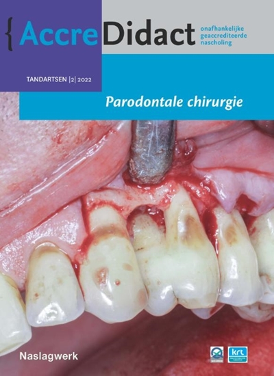 Afbeelding van AccreDidact Parodontale chirurgie