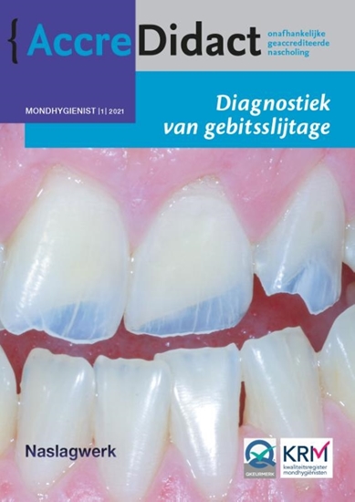Afbeelding van AccreDidact Diagnostiek van gebitsslijtage
