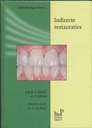 Afbeeldingen van Tandheelkundige essenties Indirecte restauraties