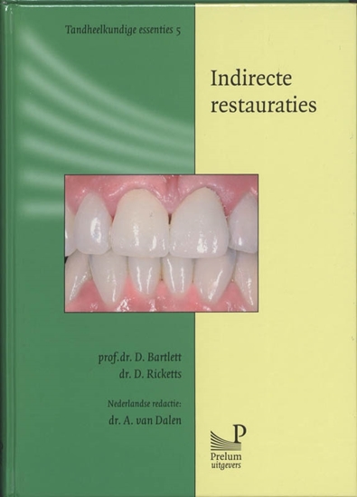 Afbeelding van Tandheelkundige essenties Indirecte restauraties