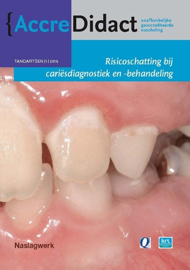 Afbeelding van AccreDidact Risicoschatting bij cariësdiagnostiek en -behandeling gebaseerd op risicoschatting