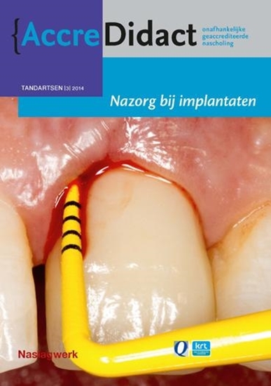 Afbeelding van AccreDidact Nazorg bij implantaten