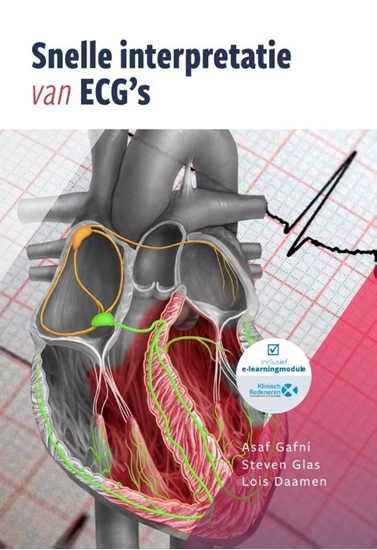 Afbeelding van Snelle interpretatie van ECG's