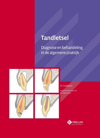 Afbeelding van Tandletsel